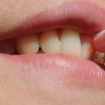 Zubný kaz na mliečnych zuboch