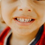 Ako sa starať deťom o mliečne zuby?