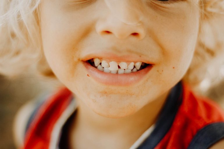 Ako sa starať deťom o mliečne zuby?